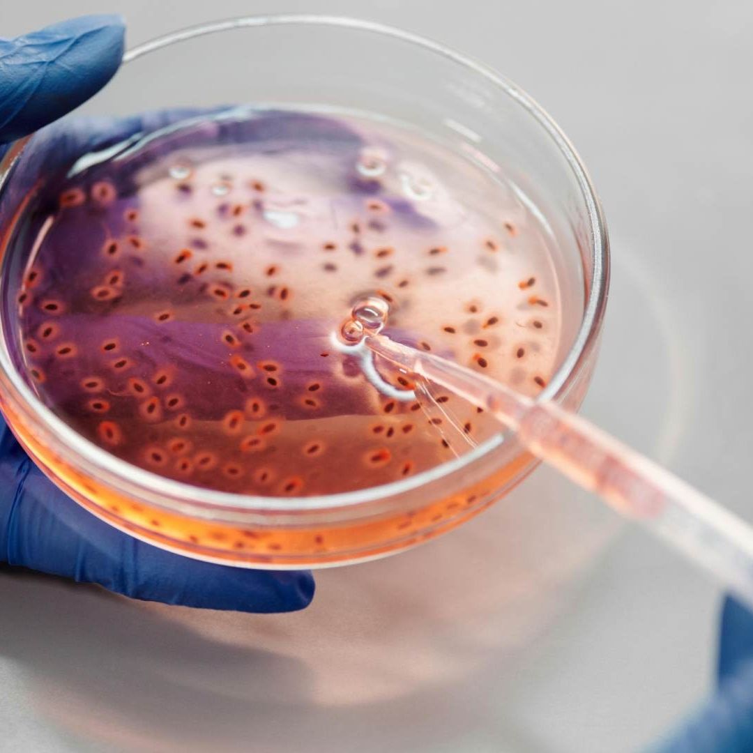 Klebsiella Oxytoca: ¿Cuáles son los Síntomas y Cómo Evitas el Contagio de la Bacteria??