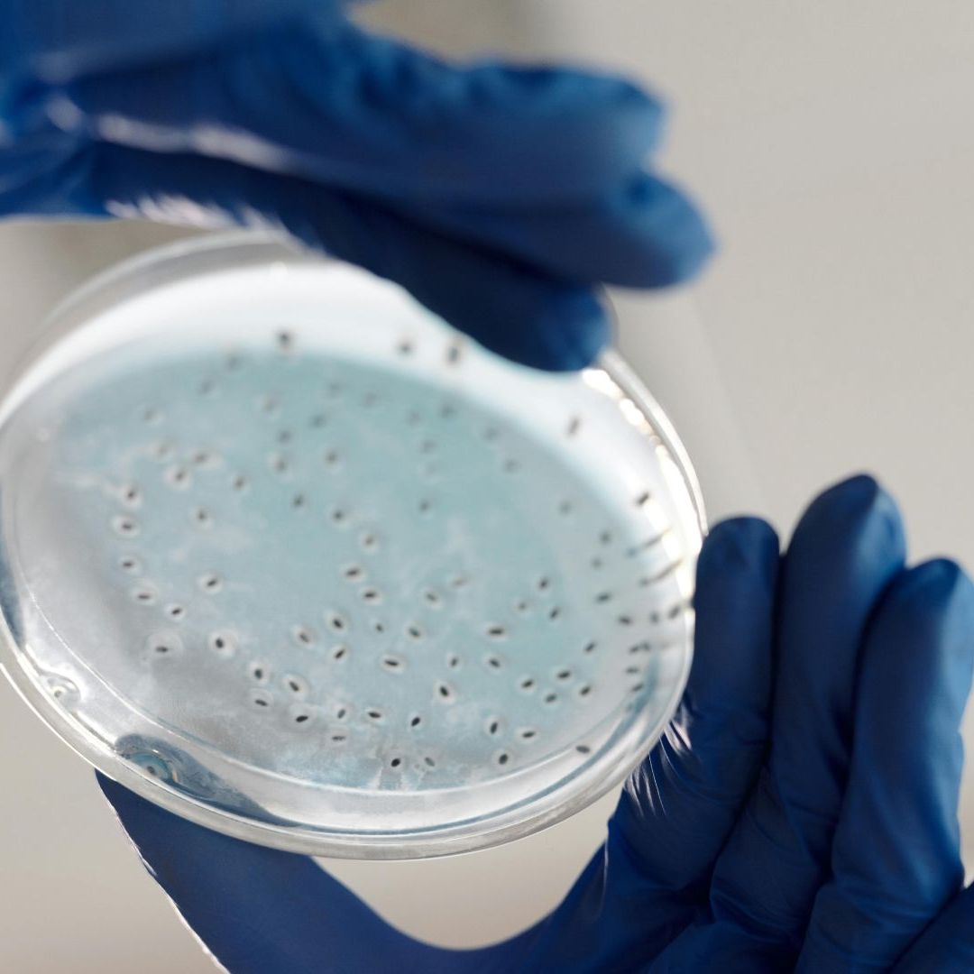 Conoce cómo se contagia la bacteria Klebsiella oxytoca, que causó la muerte de 8 niños en hospitales de Edomex