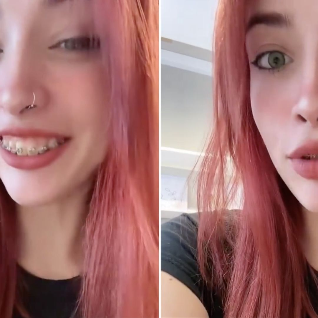 El dentista no la atiende por tener ‘residuos humanos’ en los dientes