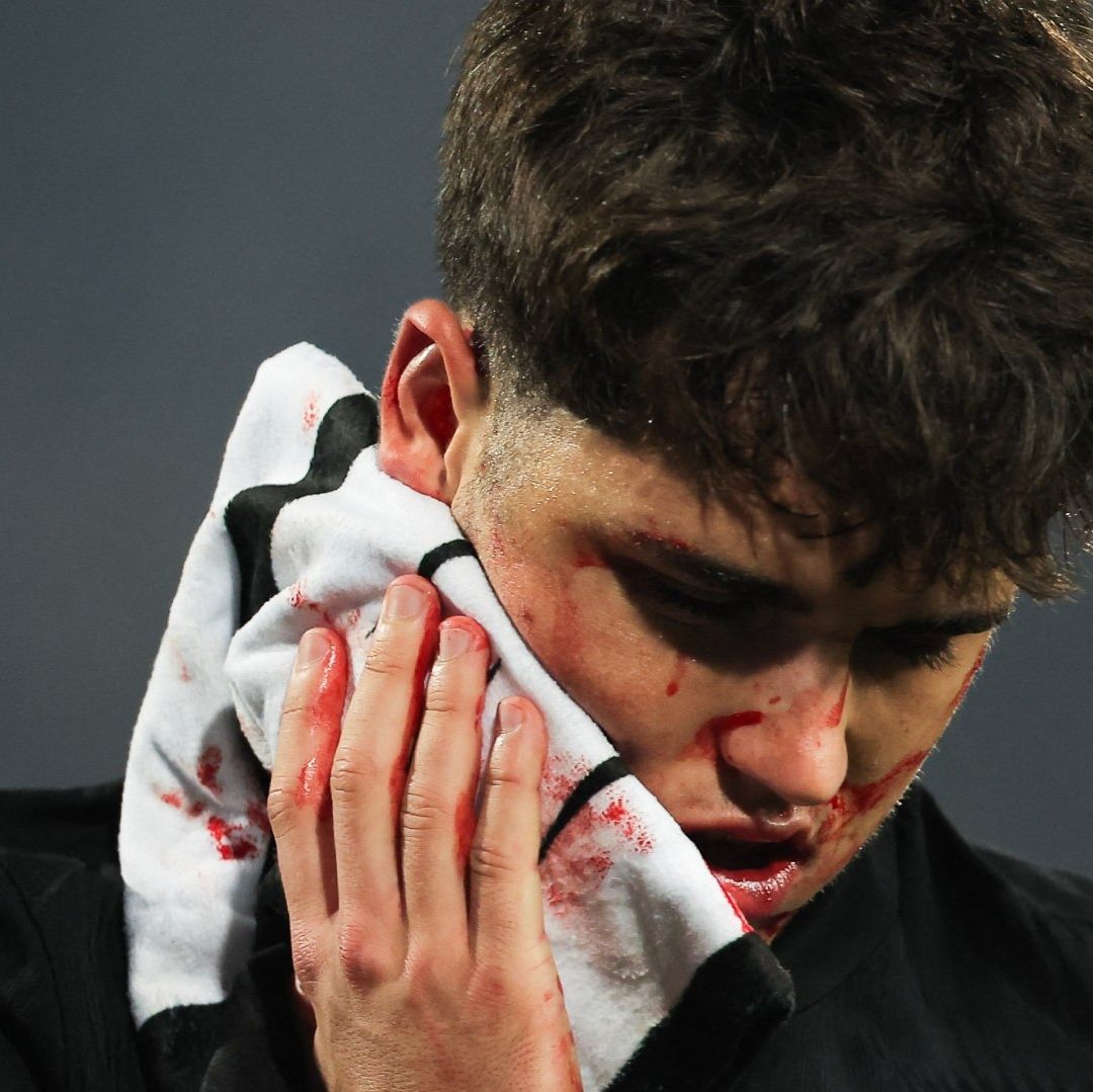Cubarsí terminó con el rostro lleno de sangre. Foto AFP