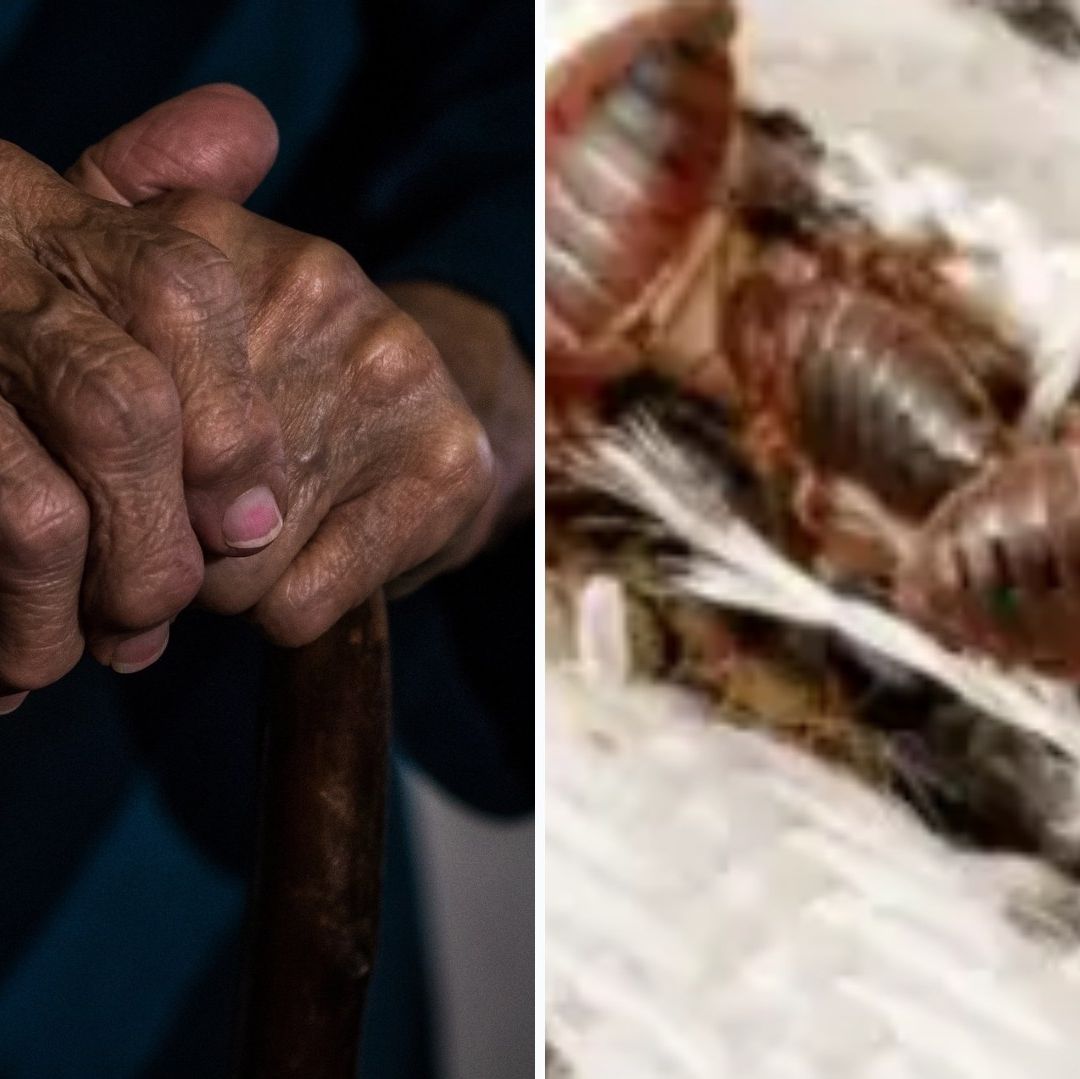 Abuelita Muere Devorada por Chinches en su Cama porque Familia No la Cuidó