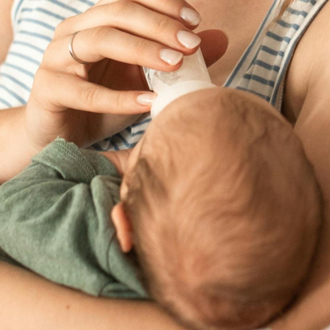 Detectan a 11 Bebés con ‘Síndrome de Hombre Lobo’; Papás Usaron Productos para Calvicie