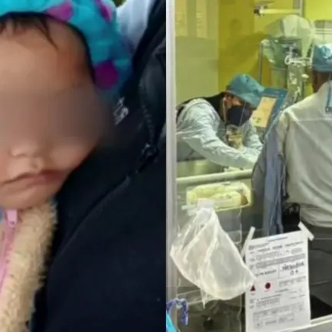 Jazlyn Azuleth, Bebé de Explosión en la Concordia, Recibe Injertos en Manos, Piernas y Cabeza