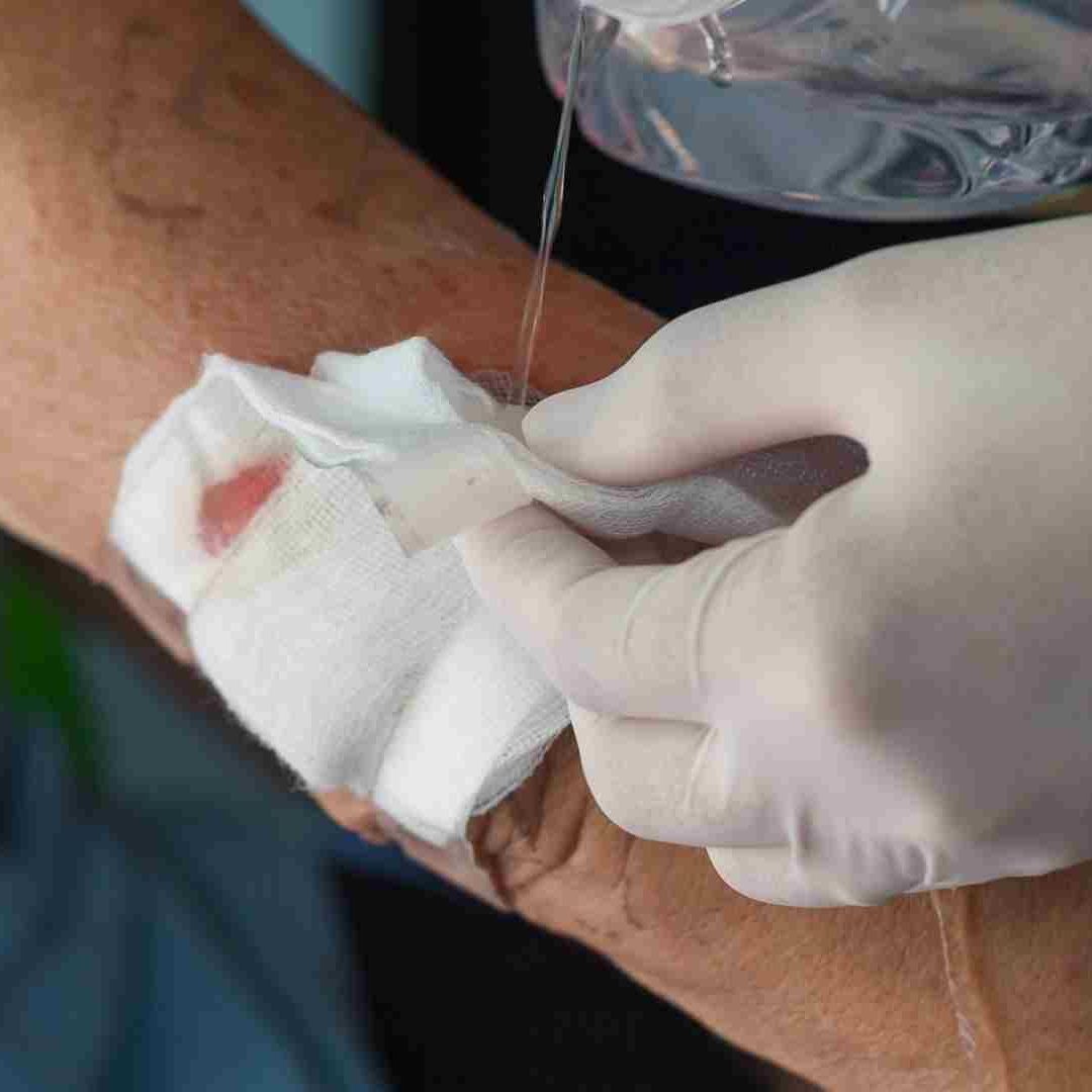 Casos de Gusano Barrenador en Humanos