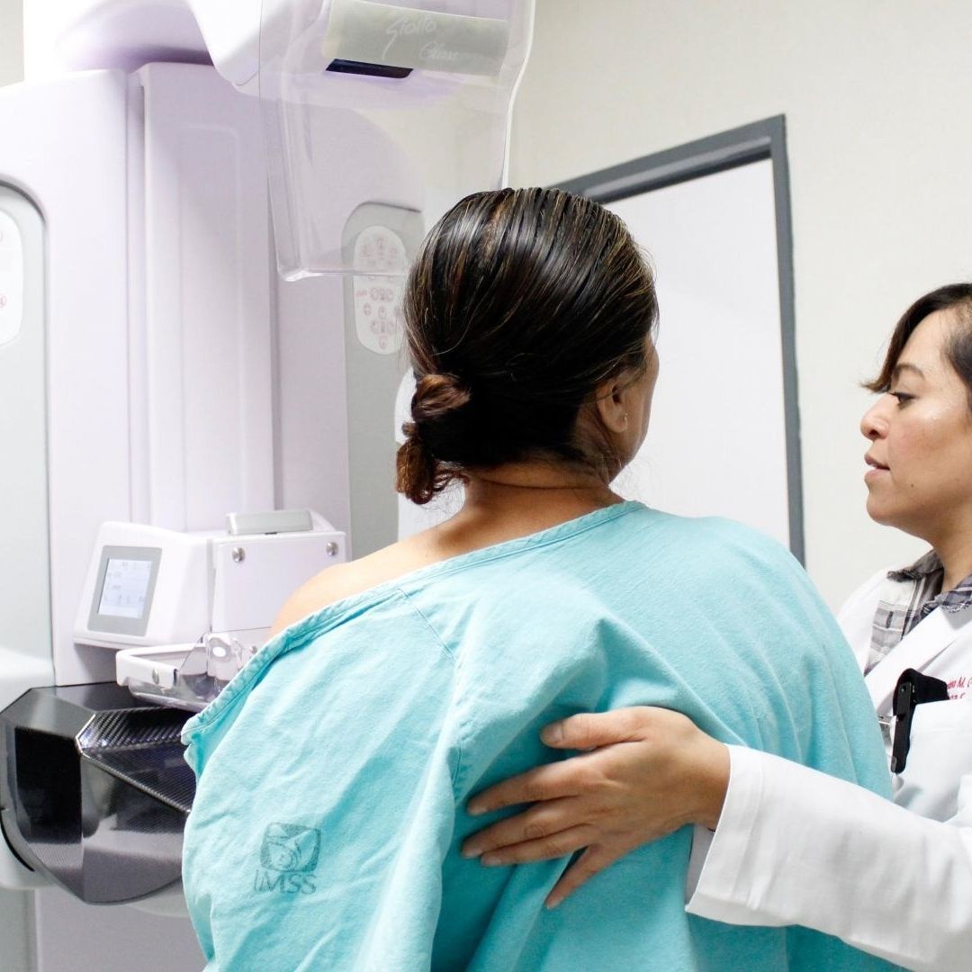Estudios en el IMSS para detectar el cáncer de mama