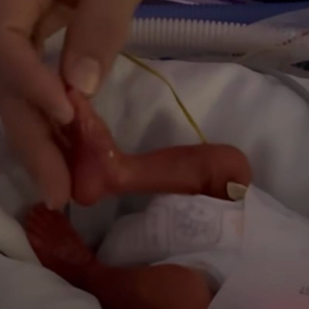 IMSS en Ciudad Juárez Salva a Bebé Prematuro de 800 Gramos; Nació con 25 Semanas de Gestación