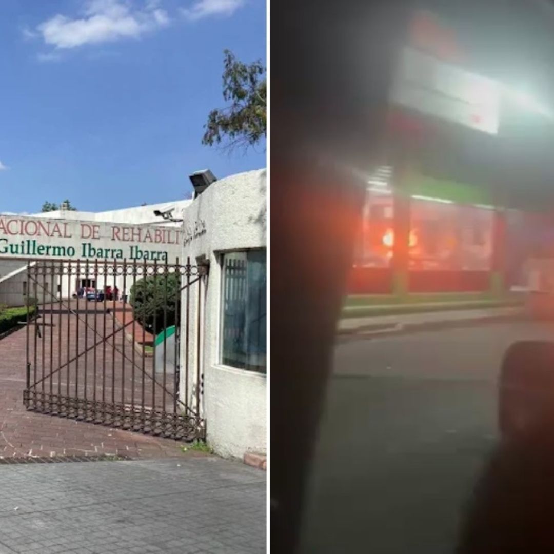 Lucha por su Vida Henry, de 2 Años con 75% de Quemaduras tras Ataque con Bomba Molotov en Chalco