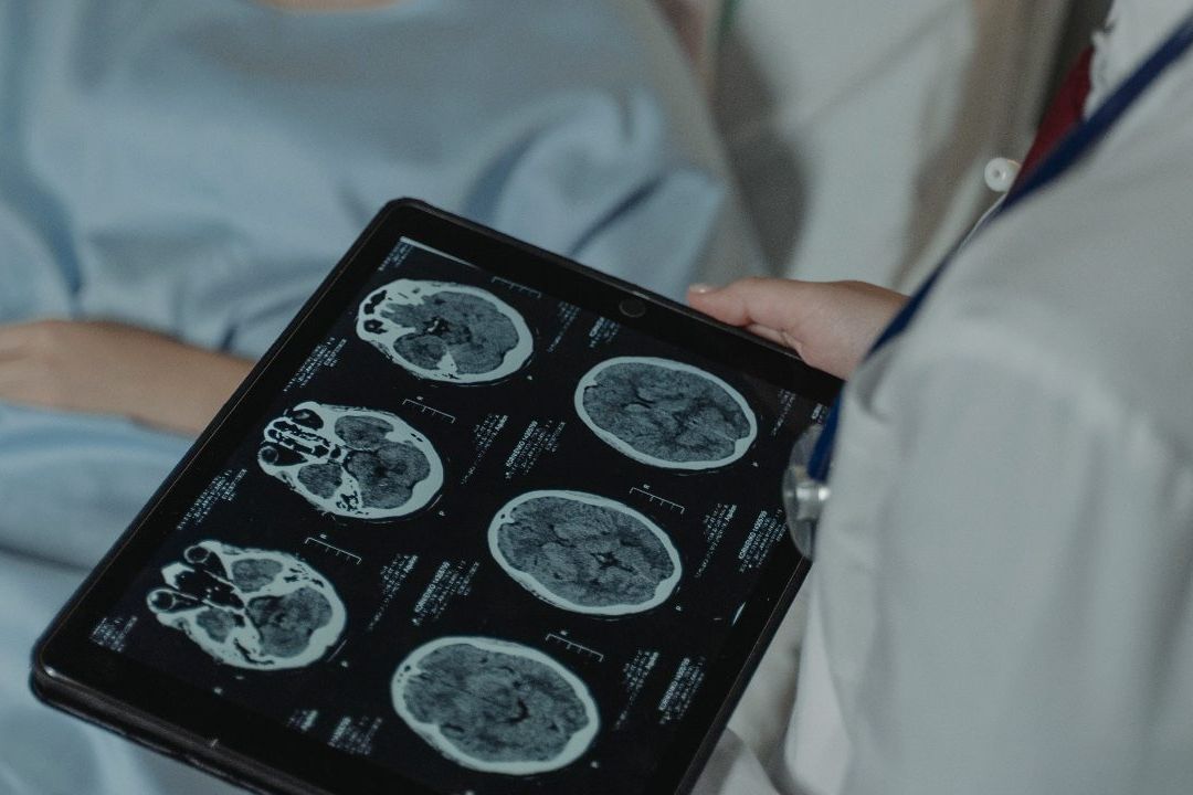 Síndrome de Rett: EUA Aprueba la solución Daybue, Primer Tratamiento contra la Enfermedad