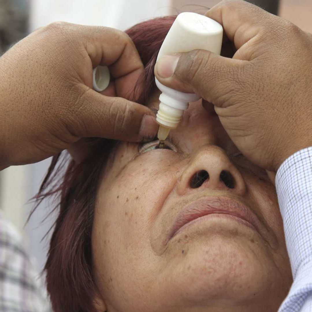 Aplicación de gotas oftálmicas a una mujer de la tercera edad.