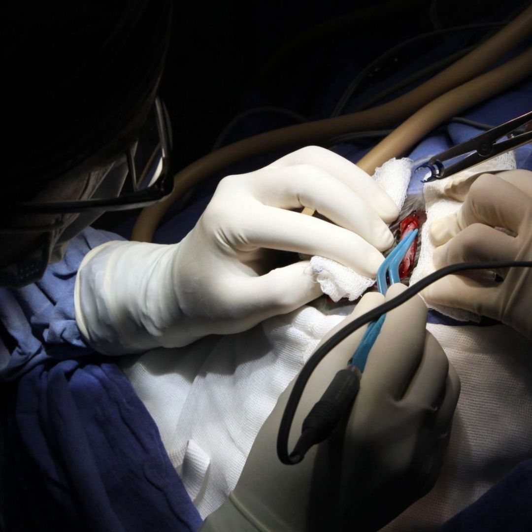 Médicos realizan una cirugía en un quirófano de hospital