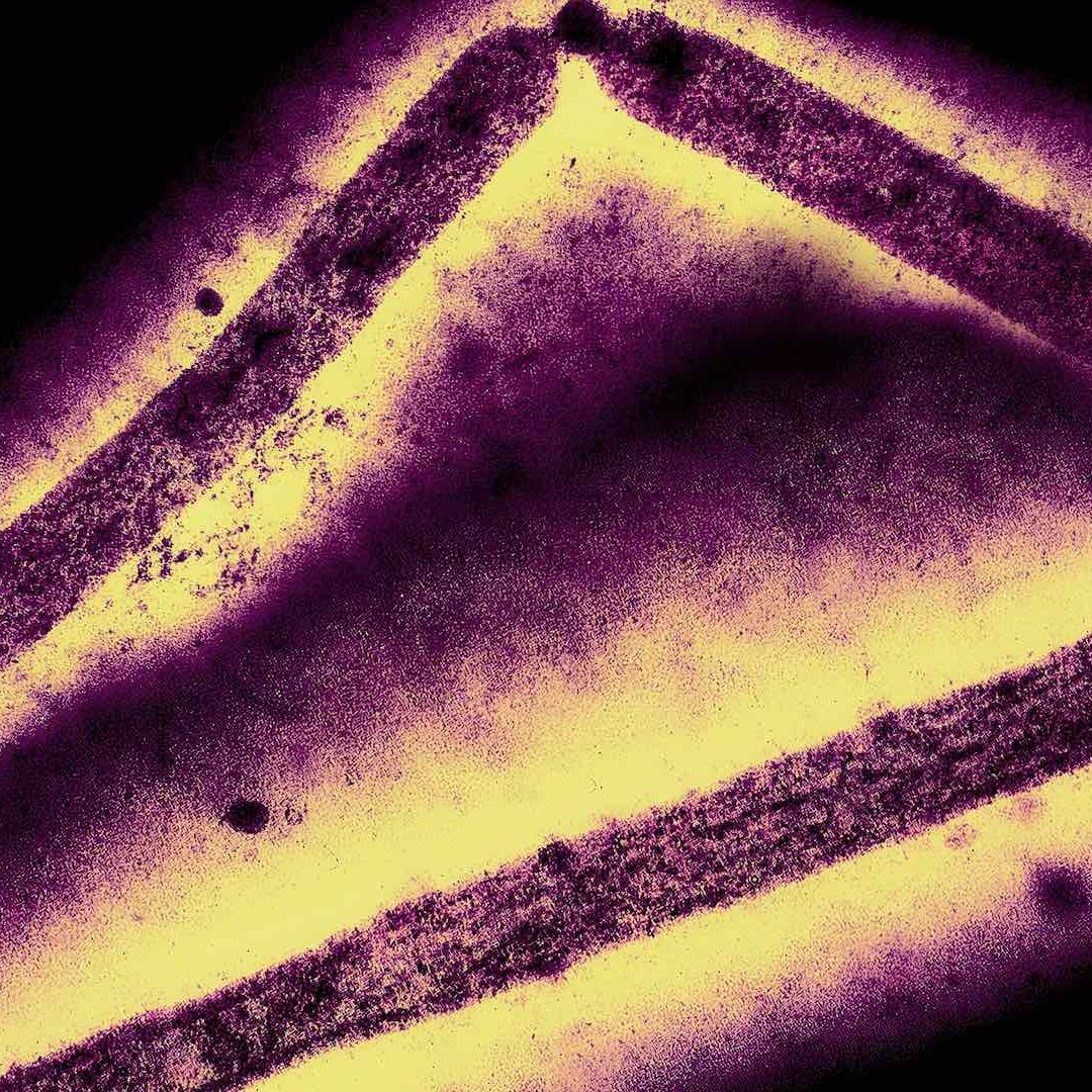 Los recientes casos de gripe aviar H5N1 en Norteamérica han levantado alarmas