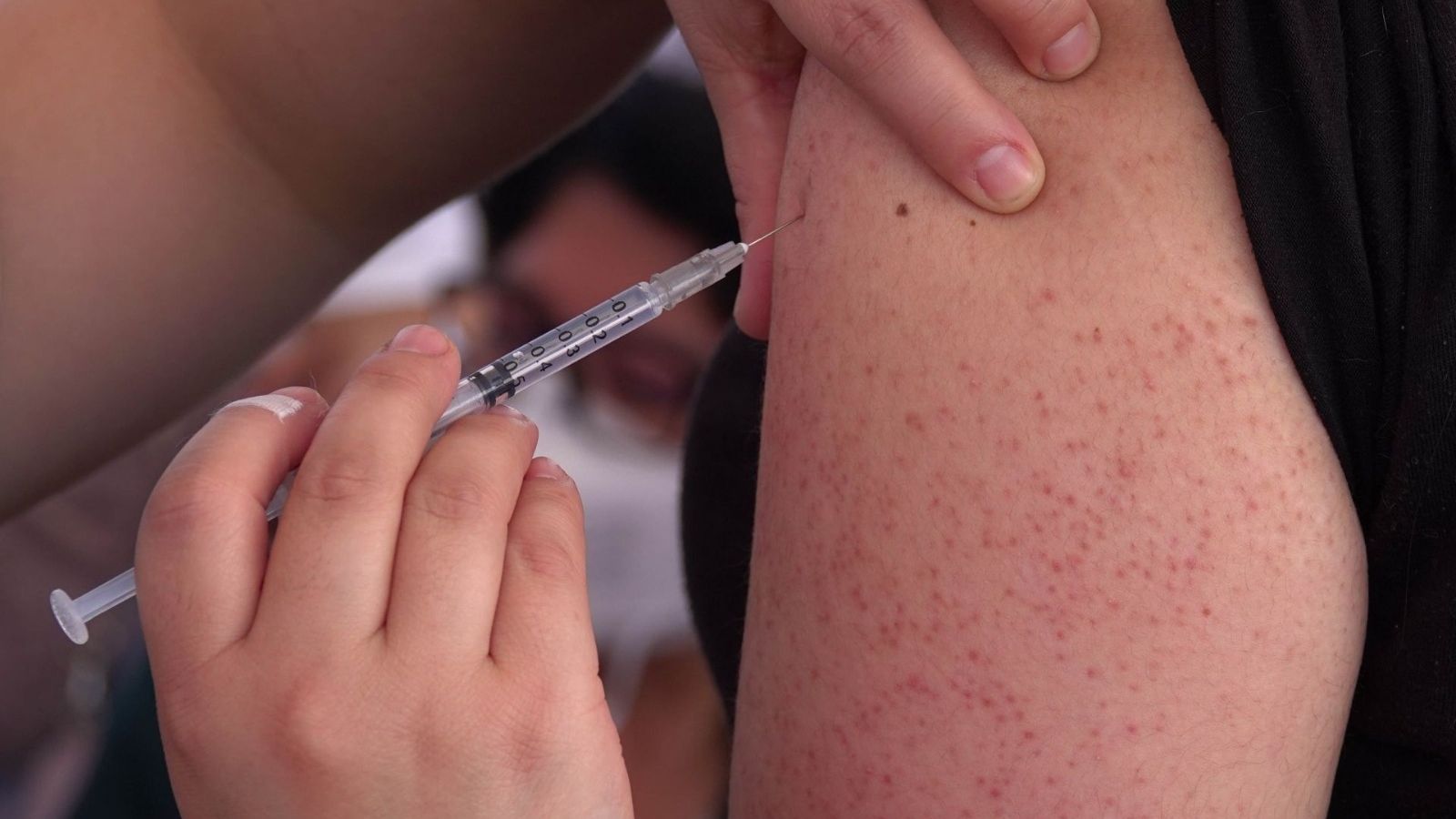 Persona vacunándose contra sarampión