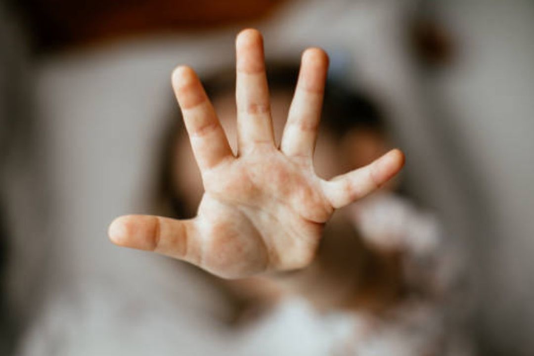 ¿Por Qué Perú Impide el Aborto Terapéutico a ‘Mila’, la Niña Violada por su Padrastro?