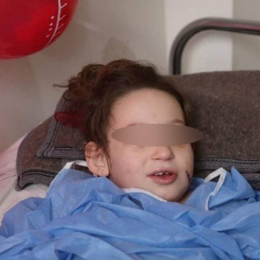 La pequeña Hanaa yace en una cama de hospital en Maarat Misrine, en la provincia septentrional de Idlib, en Siria