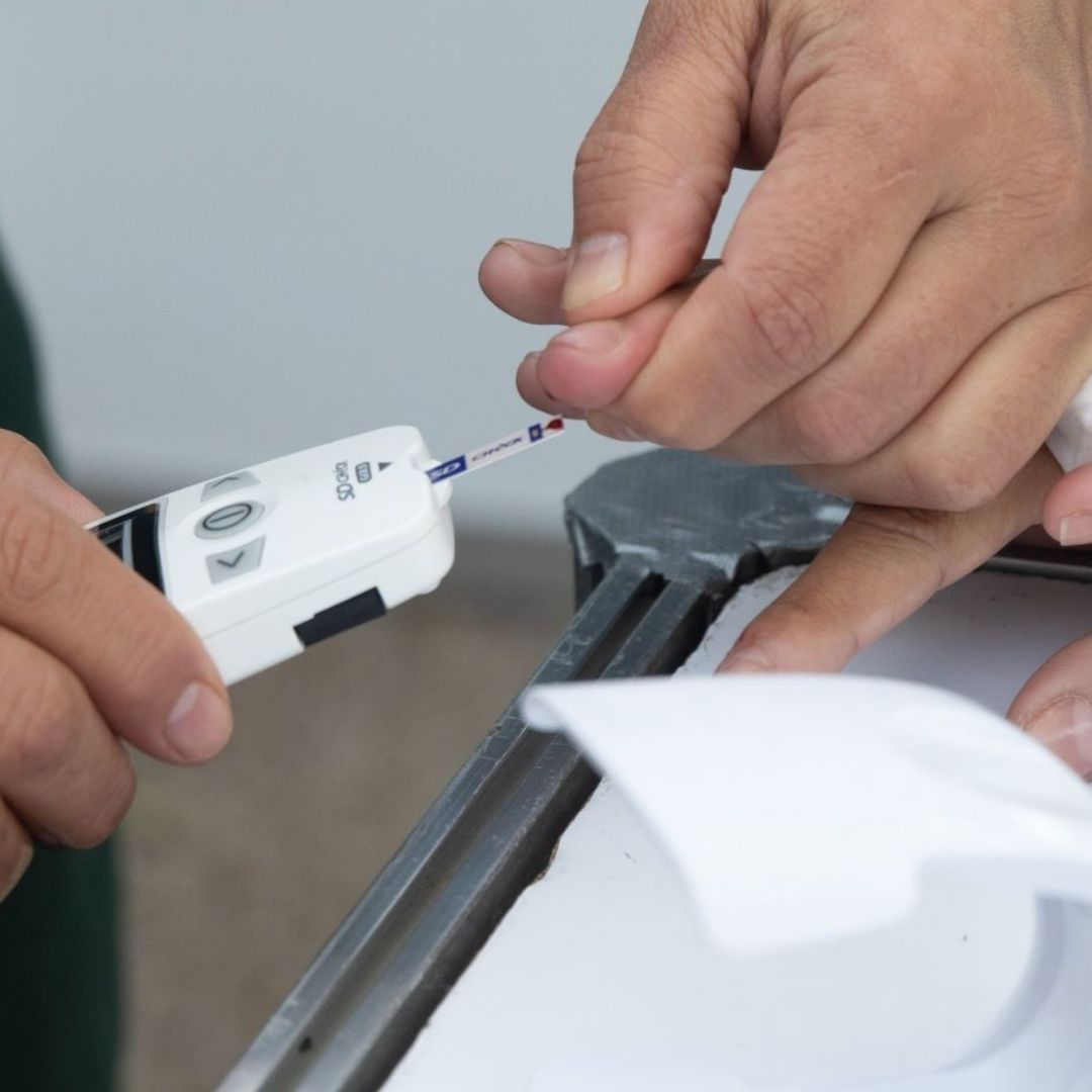 Una innovadora cirugía metabólica, conocida como transposición Ileal, ha mejorado la salud de pacientes con diabetes en México