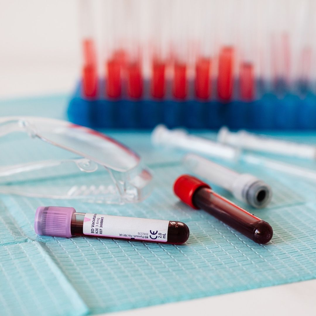 Tubos de ensayo con sangre para ser analizados