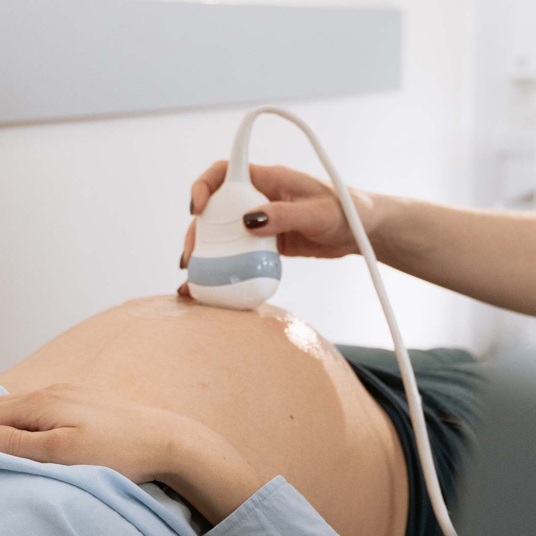 Ultrasonido a una mujer embarazada