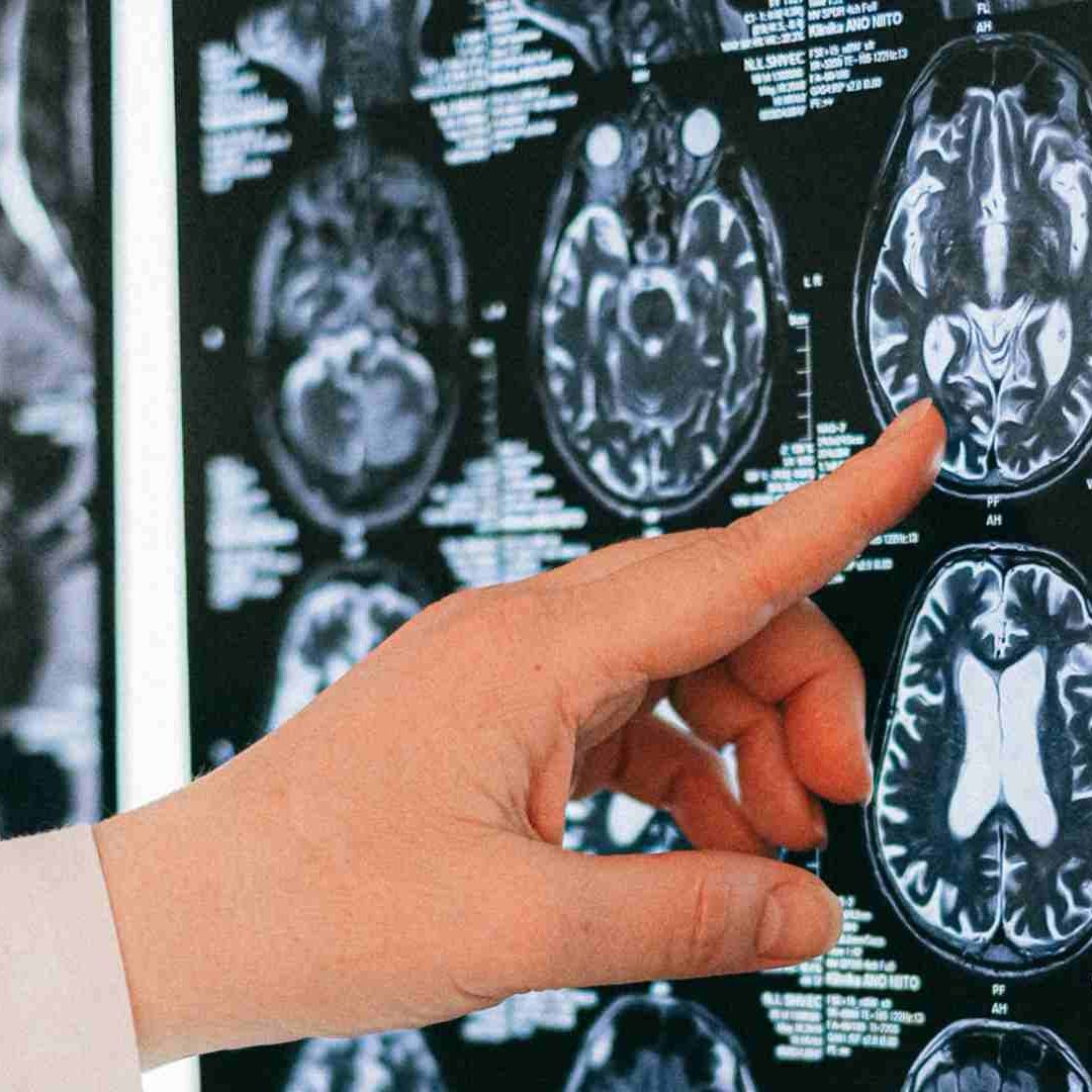 Es la primera vez que células madre pluripotenciales inducidas son usadas de esta forma en un organismo vivo