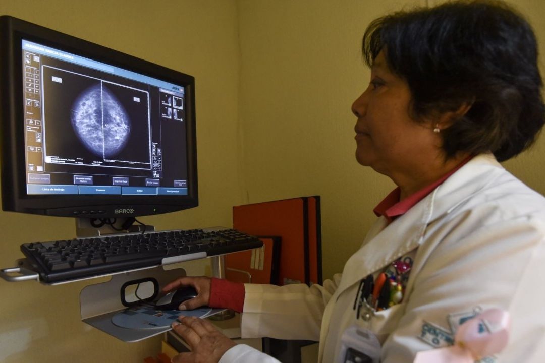 Células pueden reprogramarse para combatir cáncer de mama: Estudio