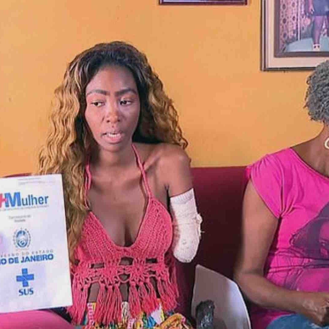 Mujer denuncia que perdió el brazo por una negligencia