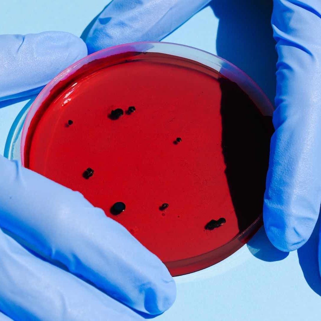 El tamaño de la mayoría de los virus es tan diminuto que solo pueden observarse a través de un microscopio electrónico