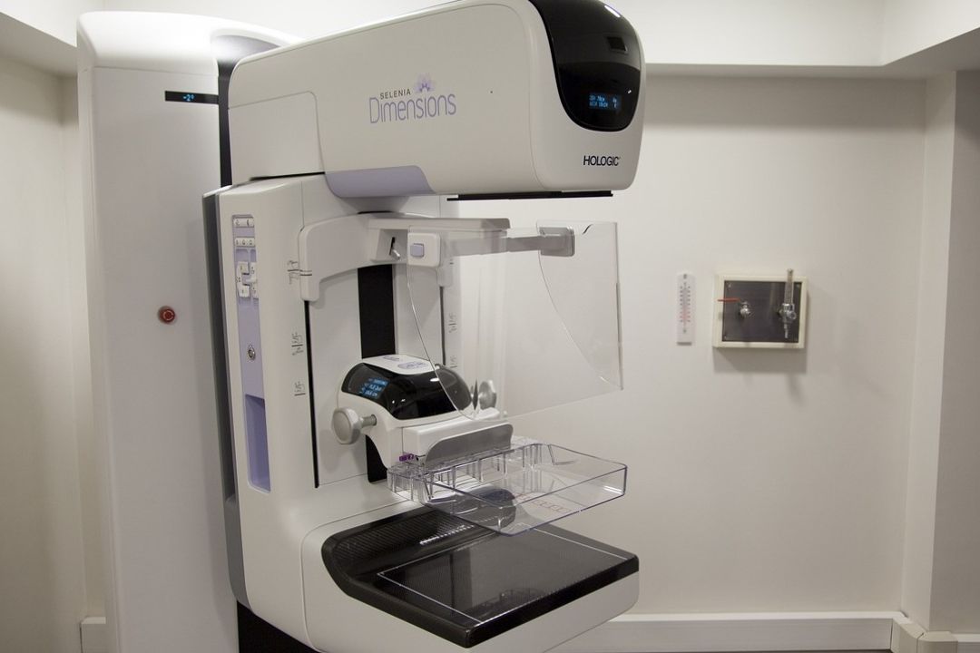 Mamografías con Inteligencia Artificial Detectan Mejor Cáncer de Mama