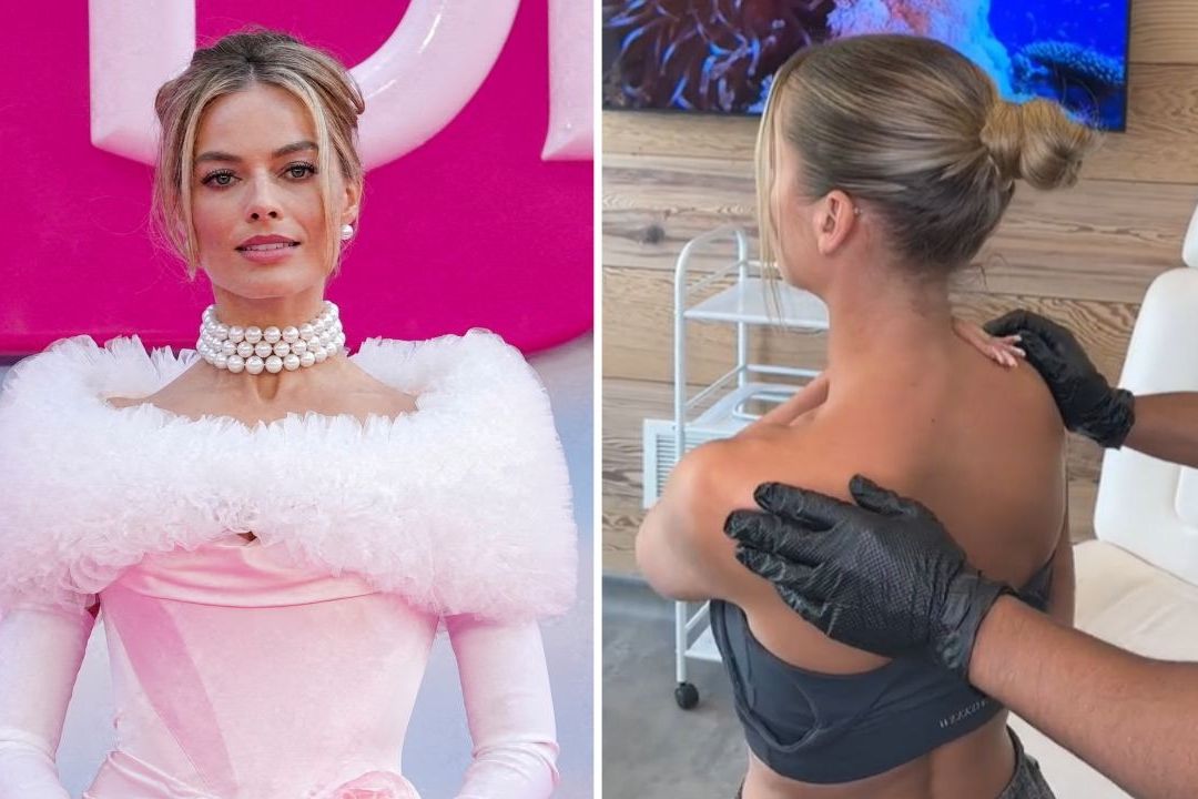 Médicos advierten por la tendencia viral 'Barbie botox', de TikTok