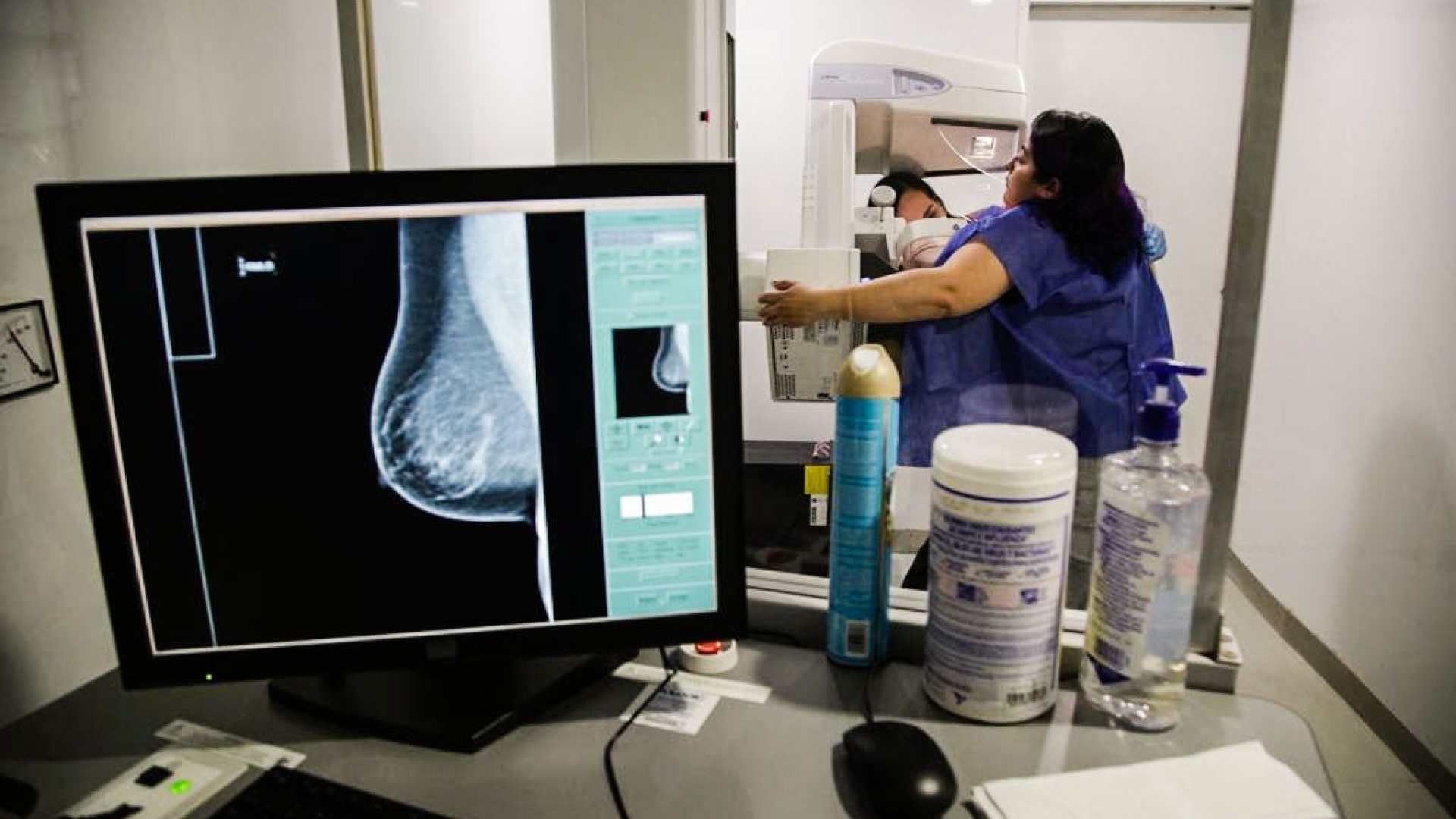 Una mujer se realiza una mastografías