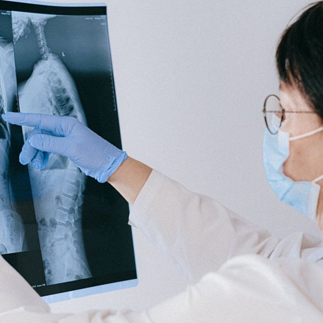 EUA aprueba nuevo medicamento contra cáncer de pulmón