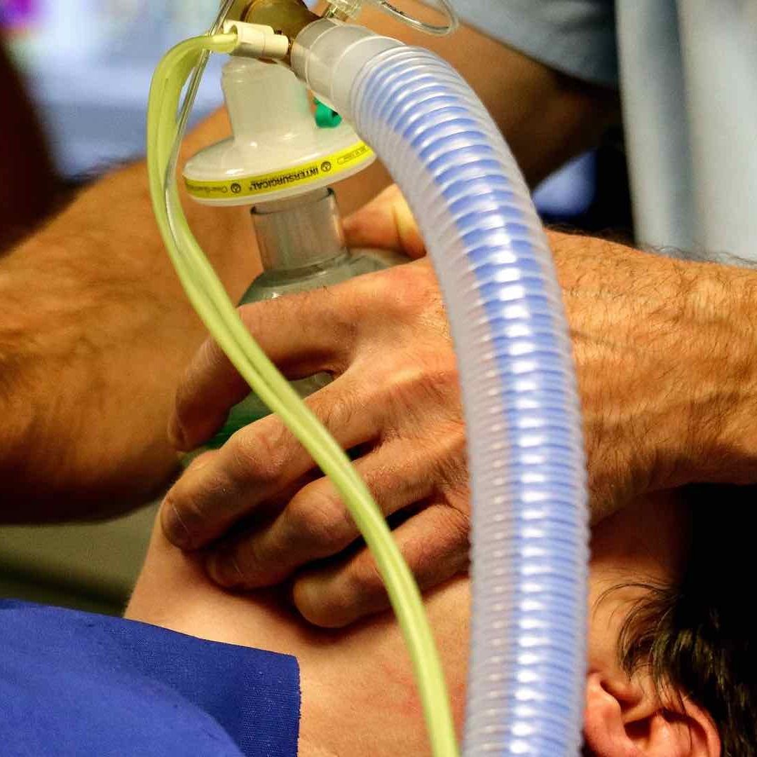 Un infarto silencioso en ocasiones no se presenta con síntomas