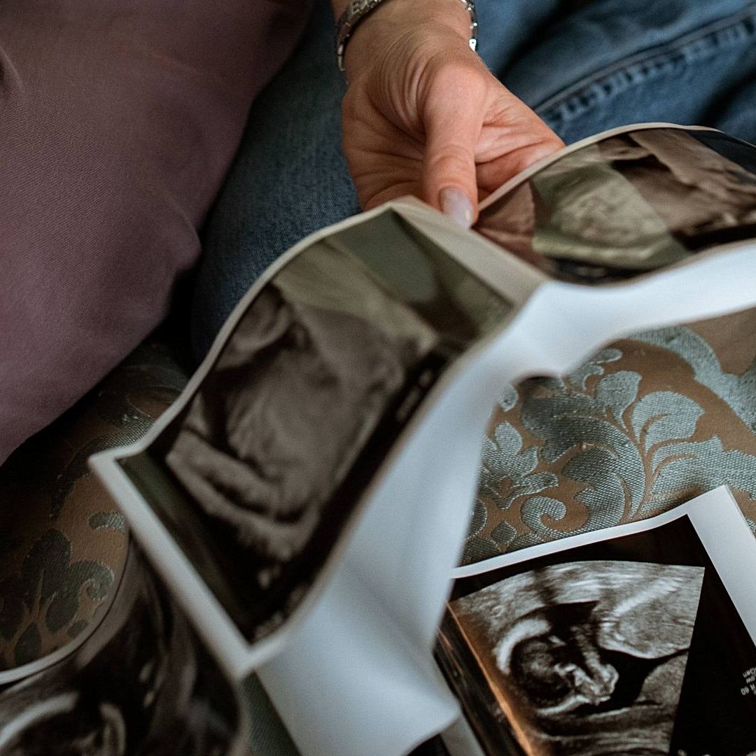 Empleado de laboratorio usa su esperma y concibe 11 hijos sin ser donante oficial de semen