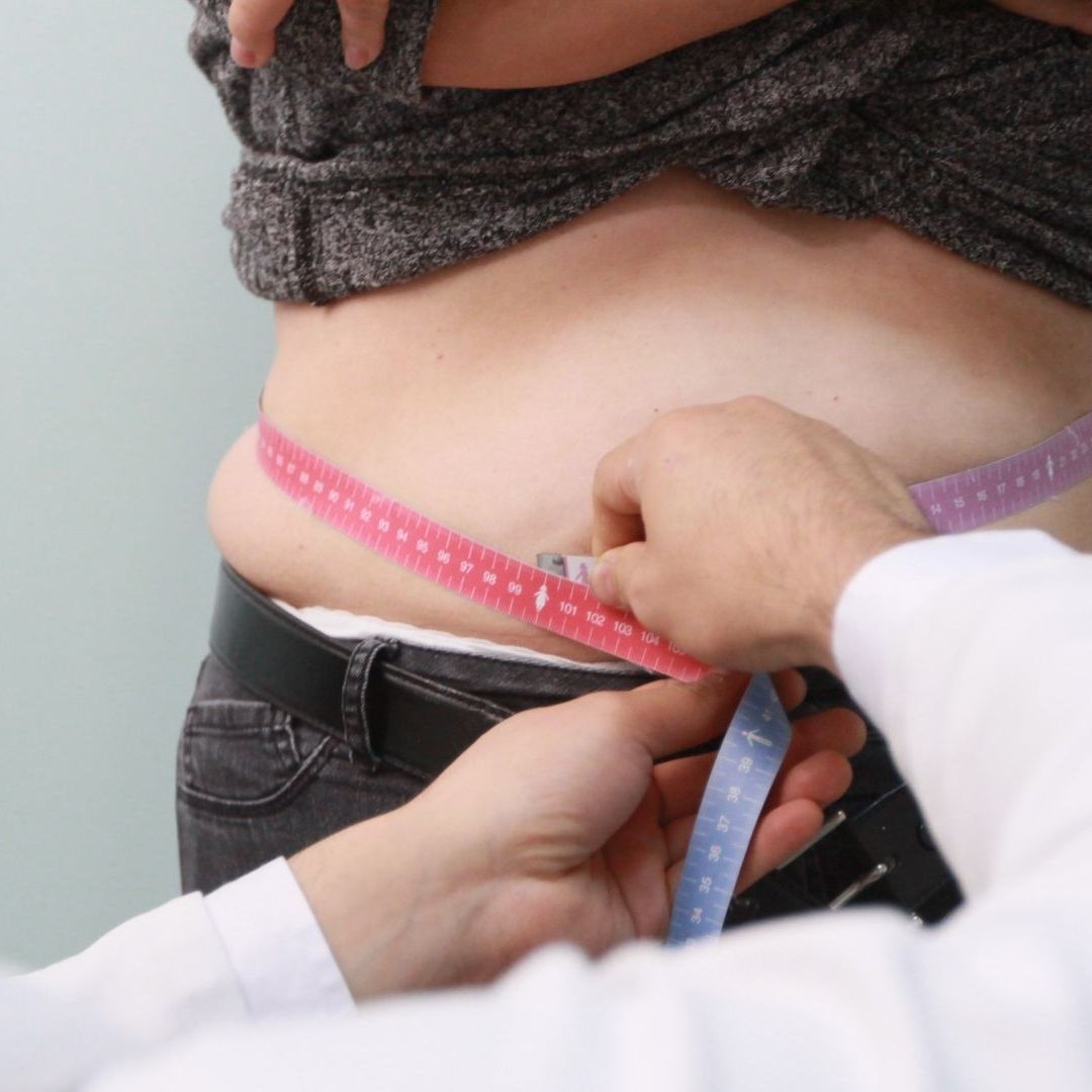 Día Mundial de la Obesidad 2024 en México