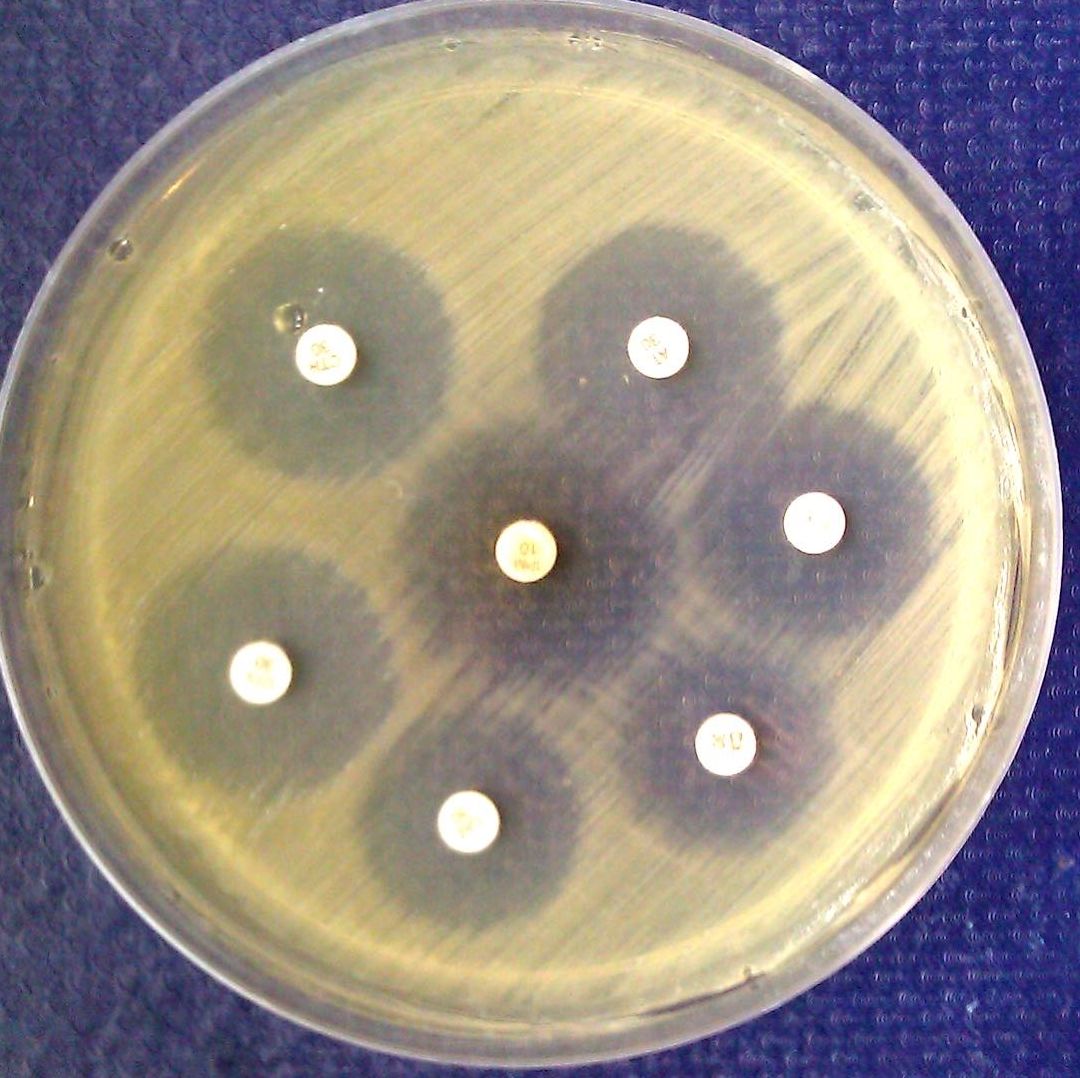 Antibióticos reaccionan sobre un cultivo de bacterias