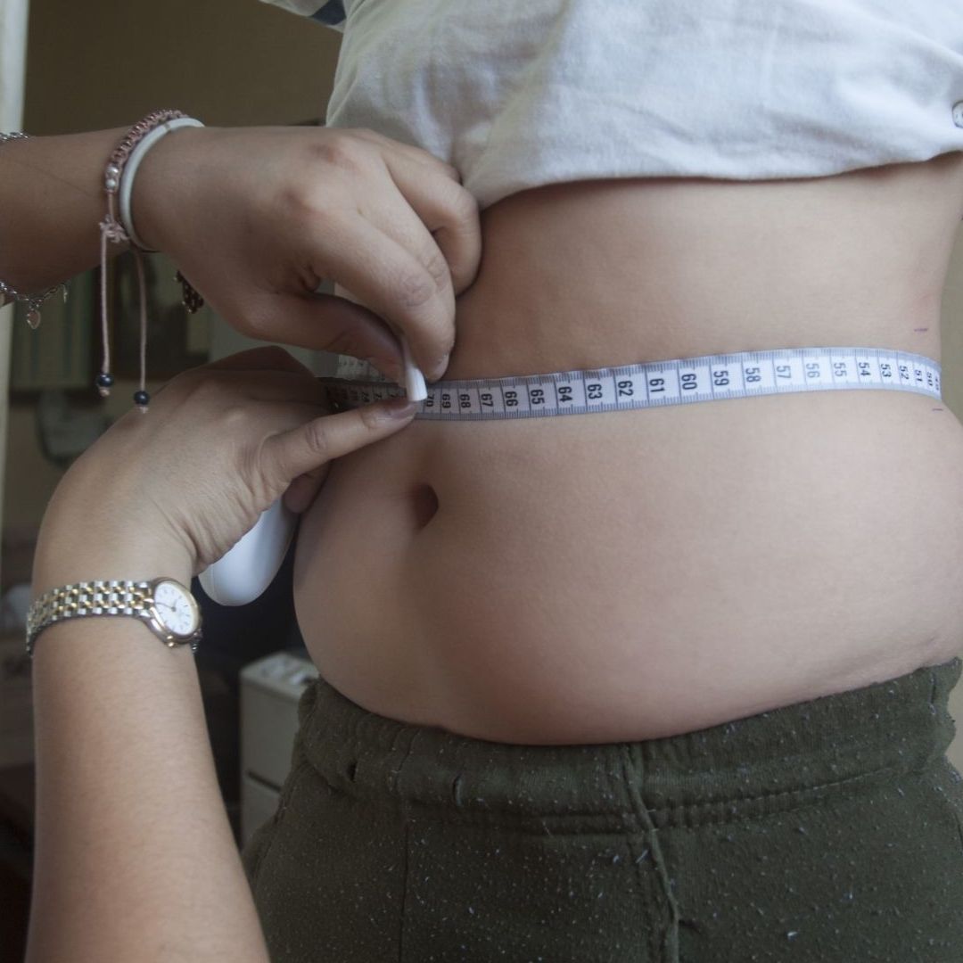Obesidad infantil