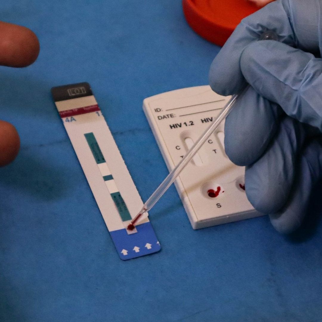 Pruebas rápidas para detectar VIH