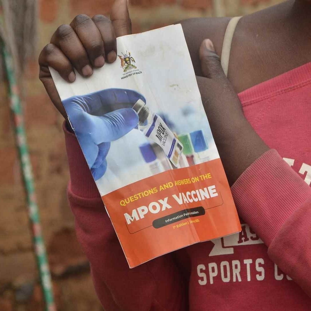 Vacuna contra mpox, también conocida como viruela símica