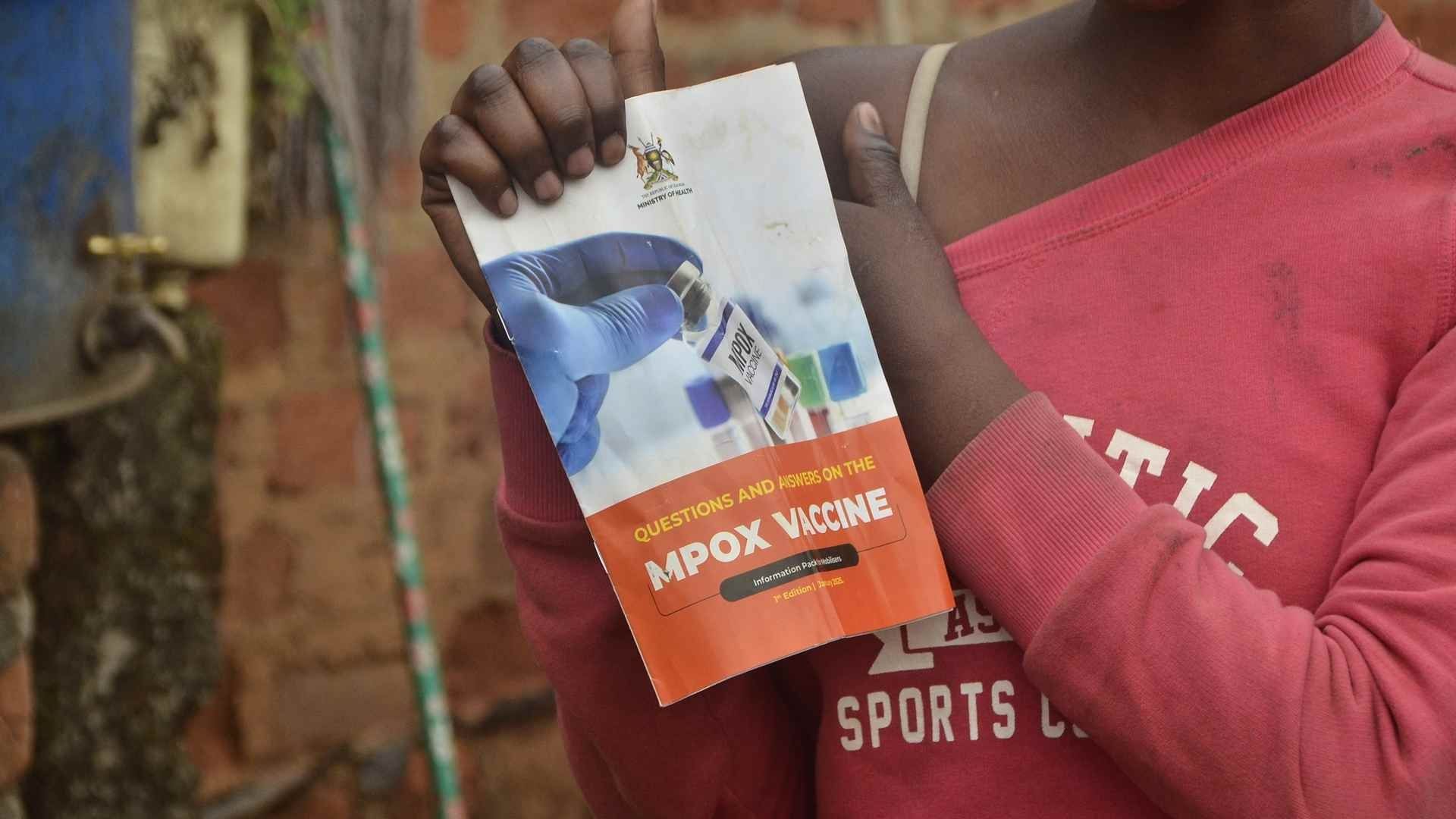 Vacuna contra mpox, también conocida como viruela símica