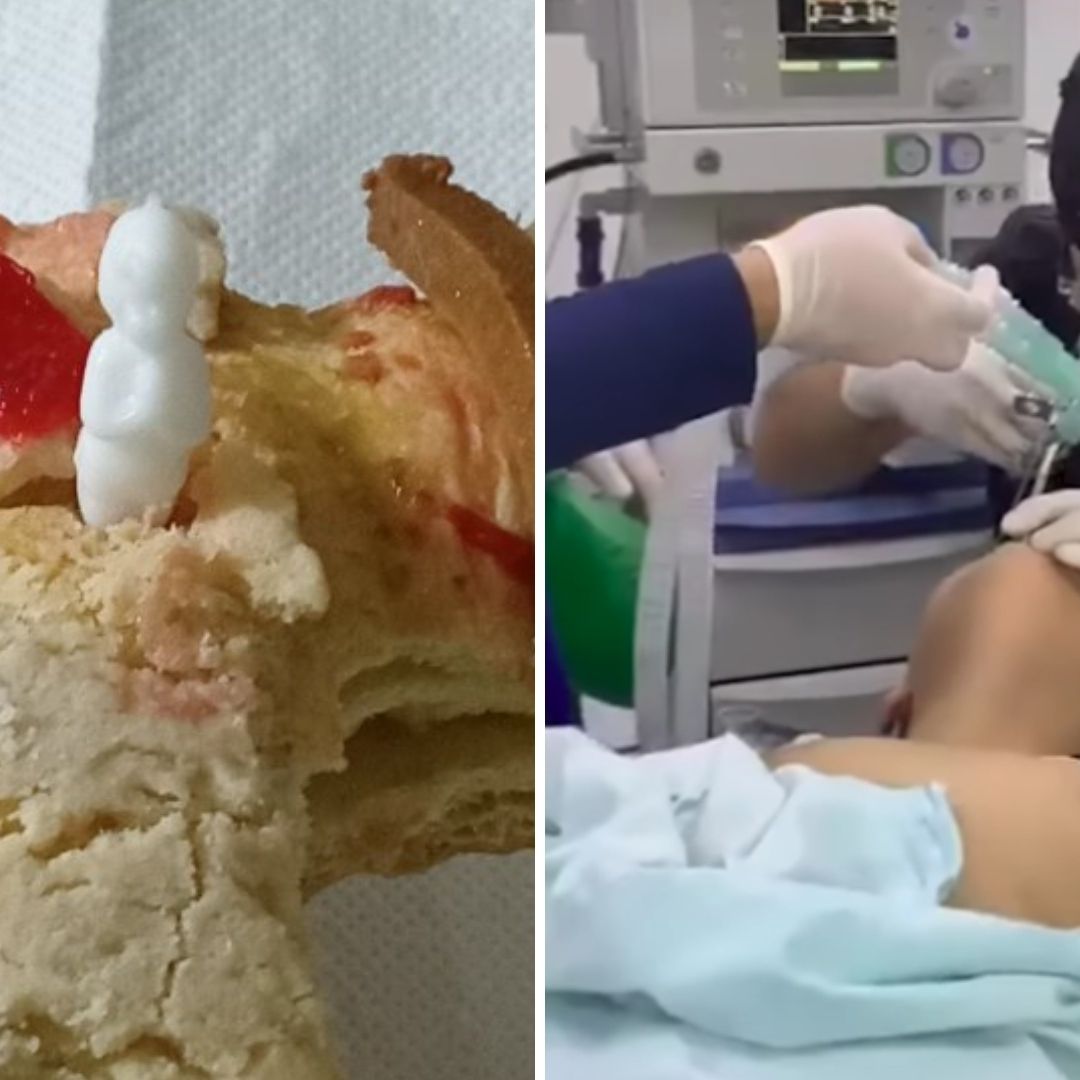 ¿No Quería Pagar los Tamales? Extraen un Muñeco de Rosca de Reyes a Paciente | Video