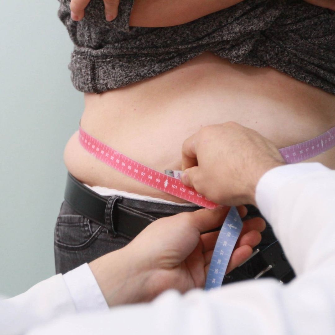 Obesidad en México, una epidemia silenciosa