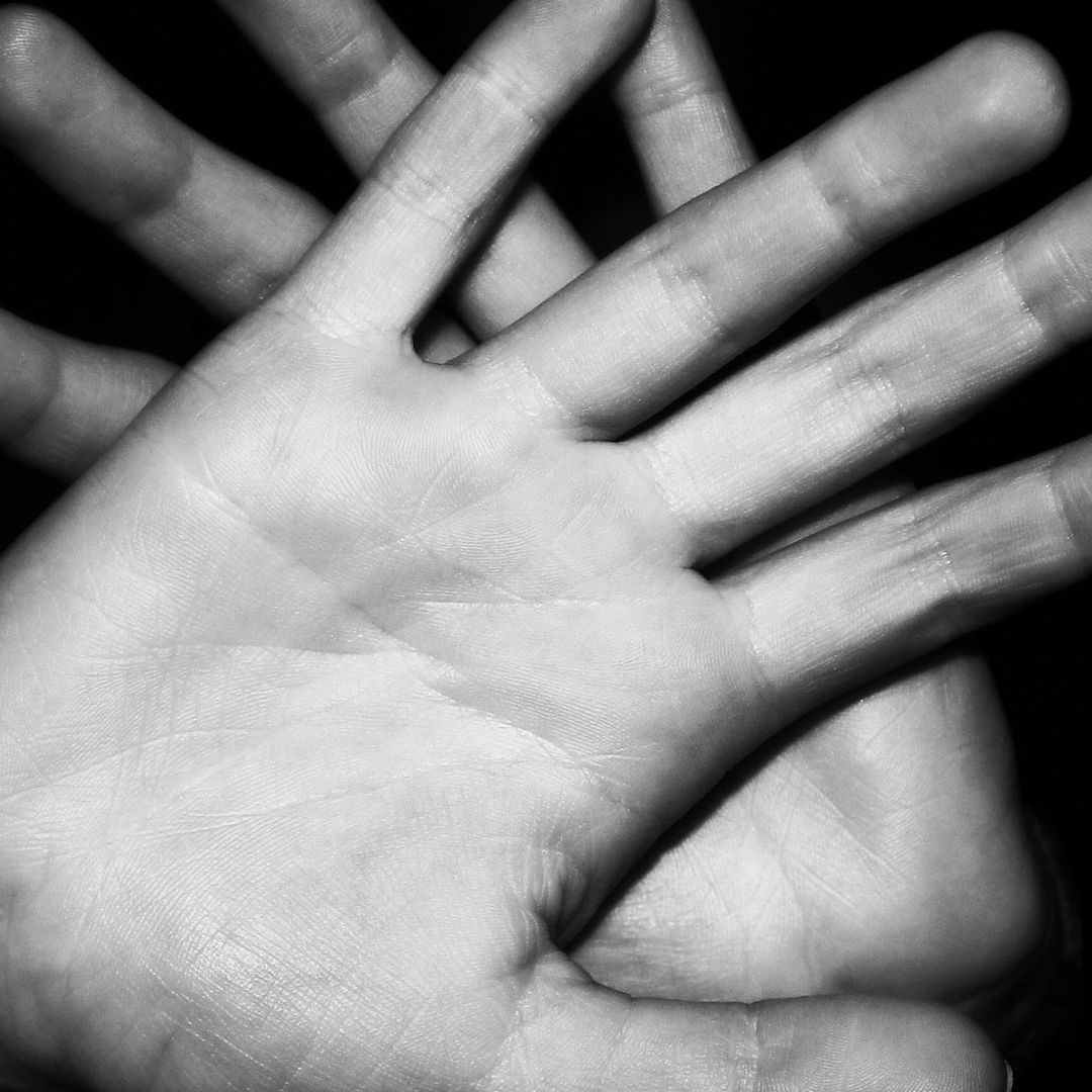 ¿Cómo actuar tras un ataque de ácido? Primeros auxilios