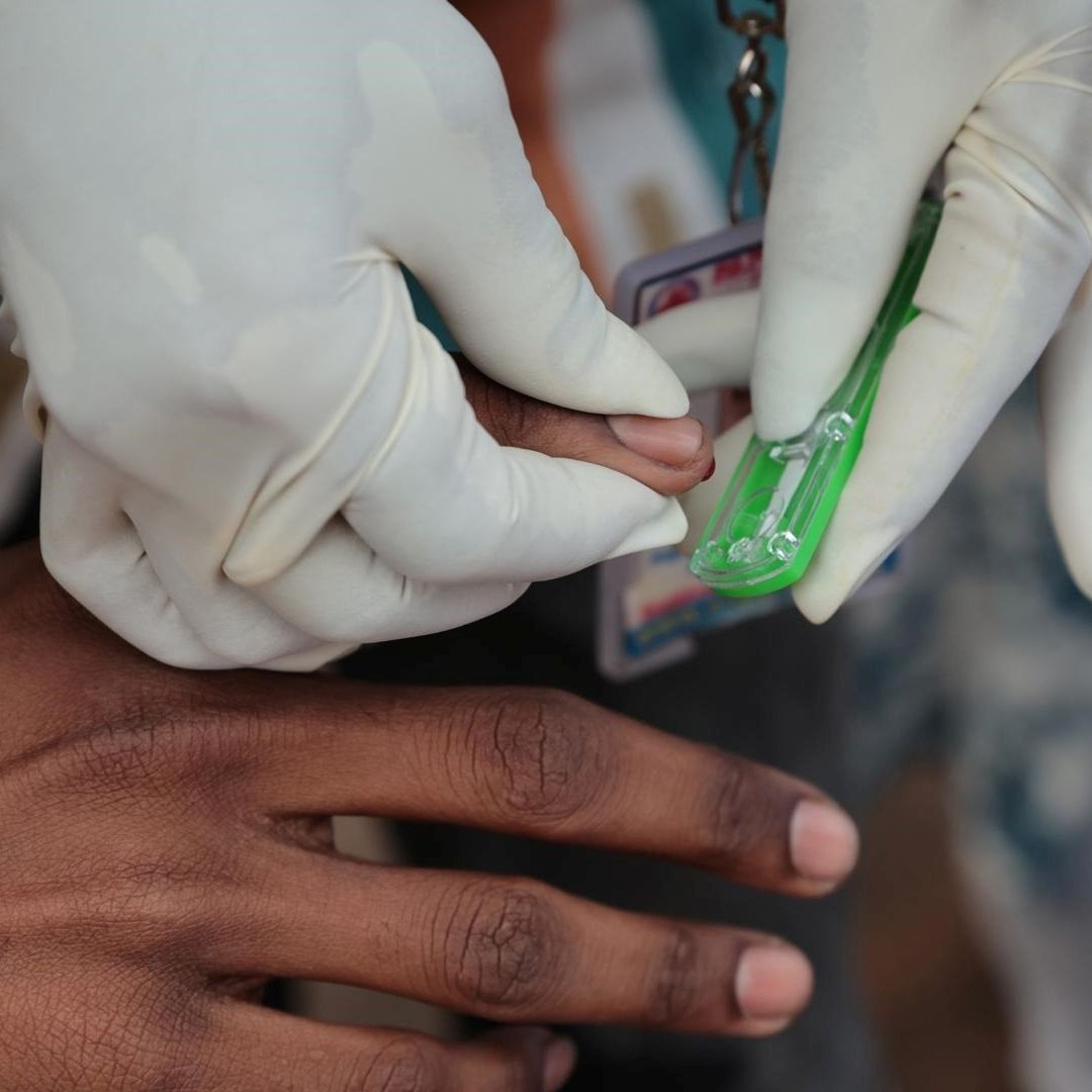 Prueba de VIH Sida para pacientes