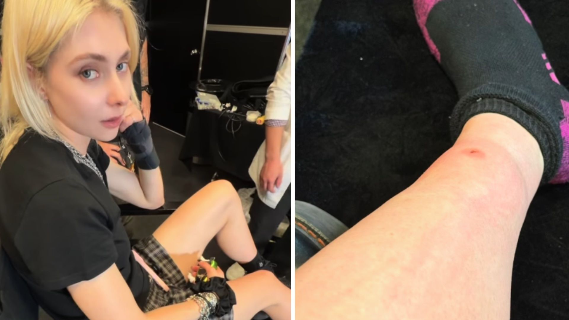 Taylor Momsen, de The Pretty Reckless, Sufre Mordida de Araña en Gira con AC/DC en México