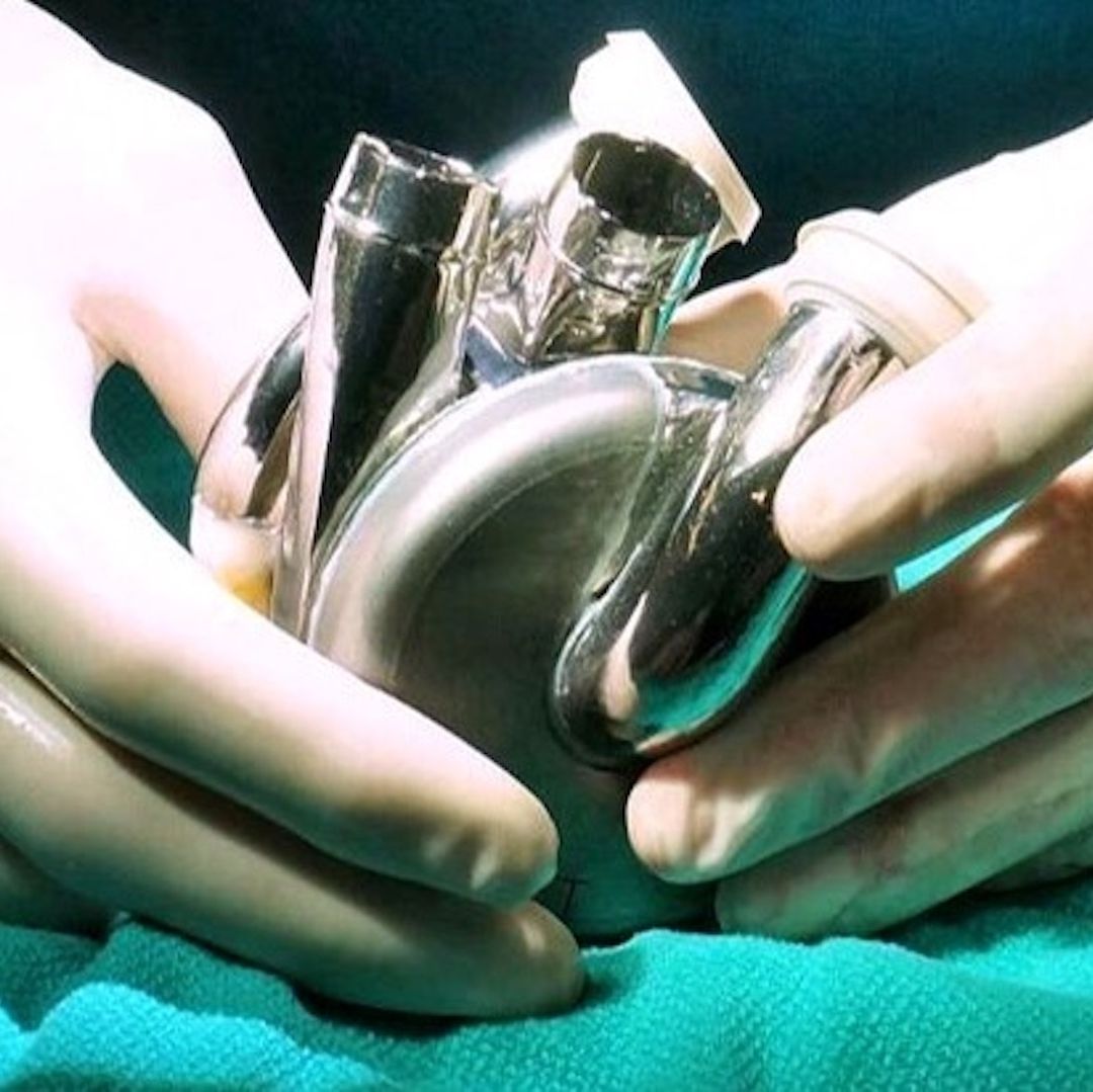 Bivacor, compañía responsable del primer corazón artificial