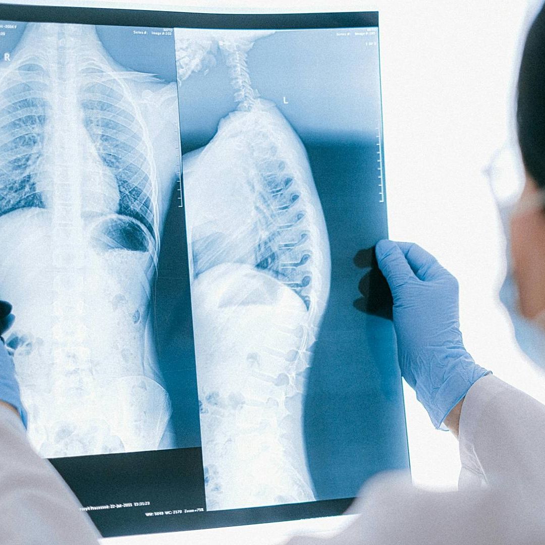 Investigación analiza efecto de microplásticos en pulmones