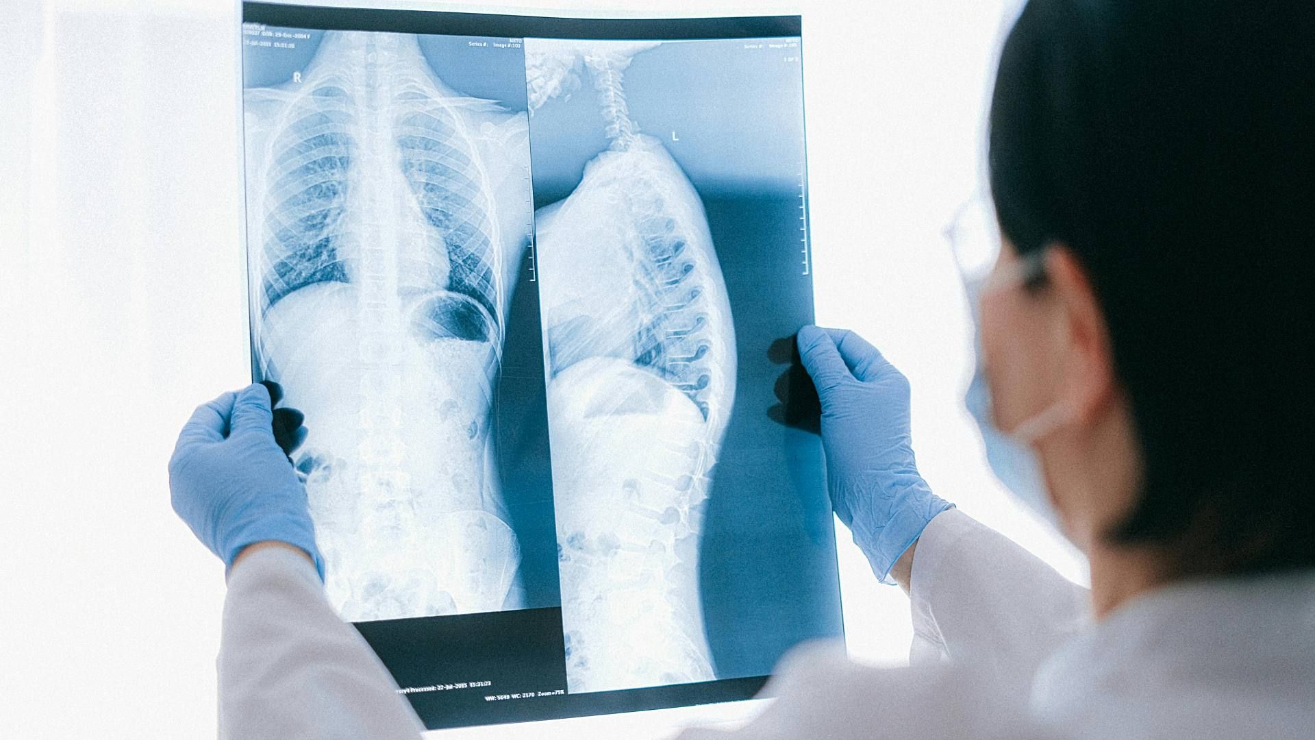 Investigación analiza efecto de microplásticos en pulmones
