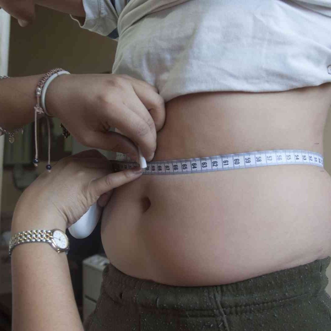 Obesidad infantil