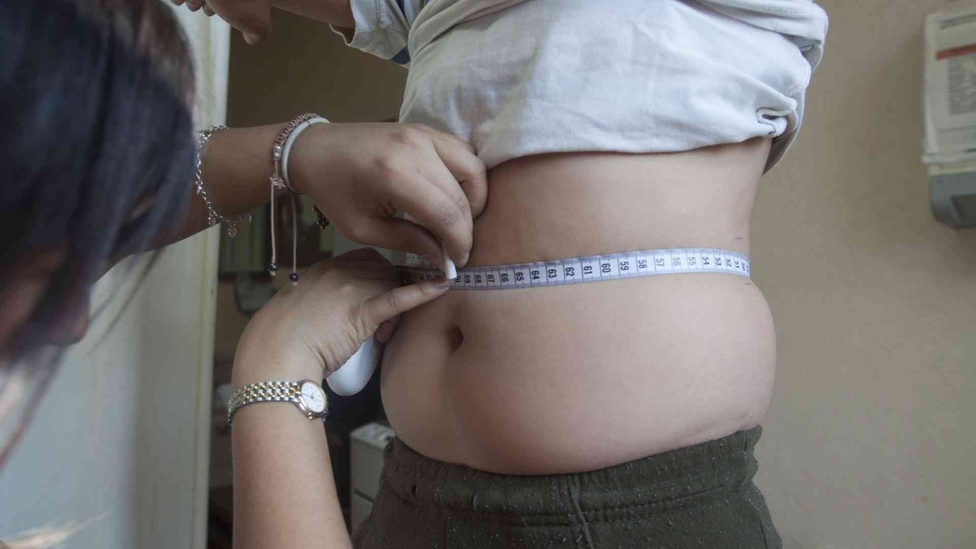 Obesidad infantil