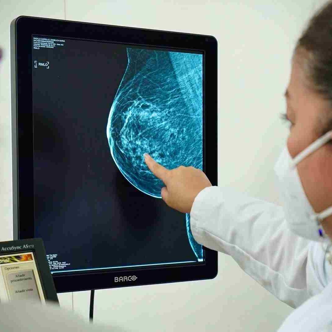 La mastografías se realizan a partir de los 40 años.