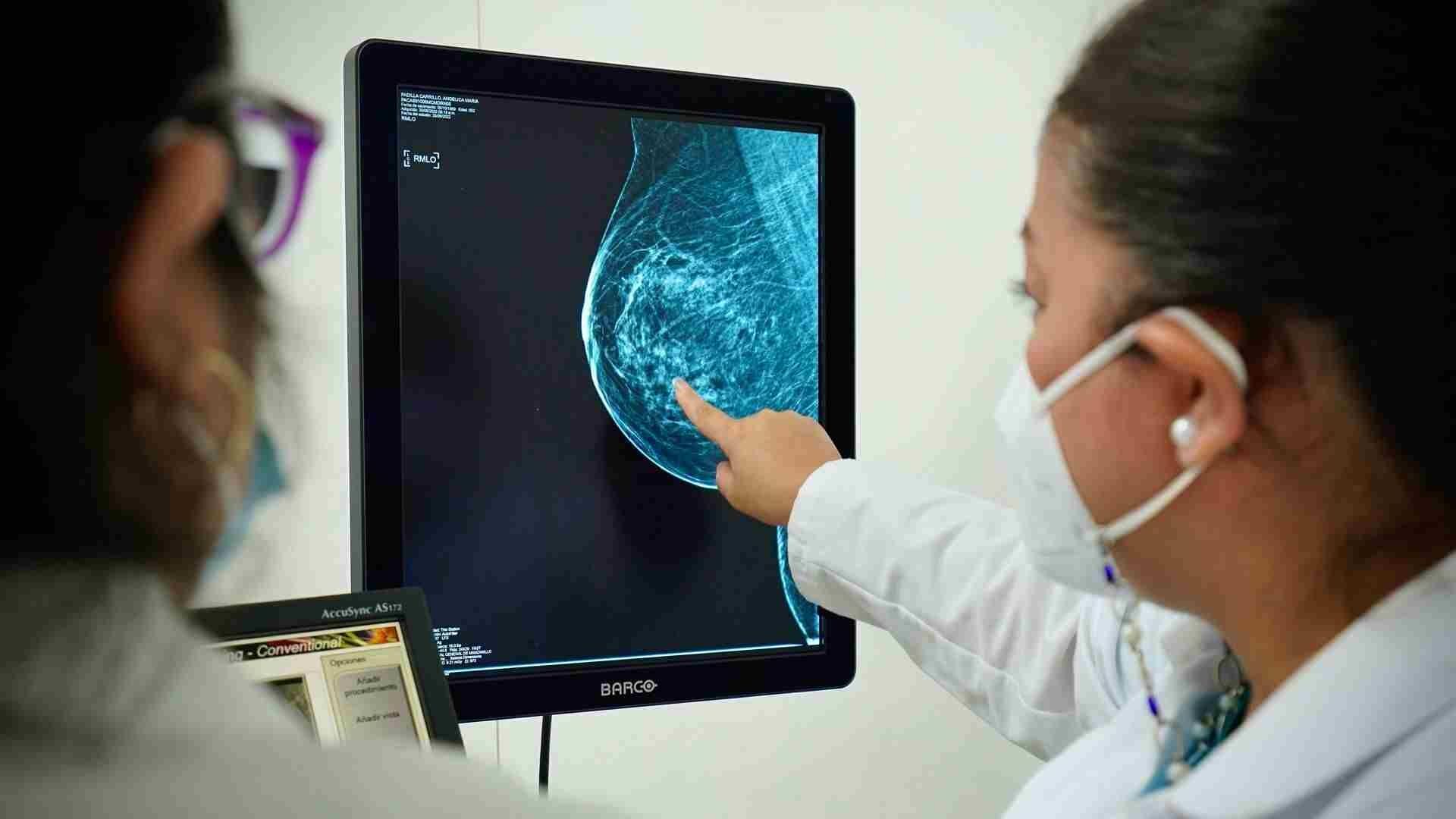 La mastografías se realizan a partir de los 40 años.
