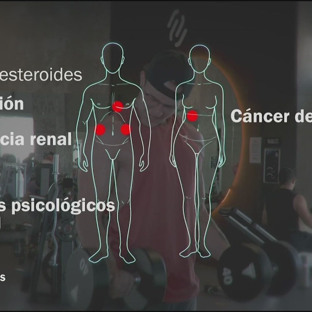 Consecuencias de Usar Esteroides Anabólicos: de Insuficiencia Renal a Trastornos Psicológicos